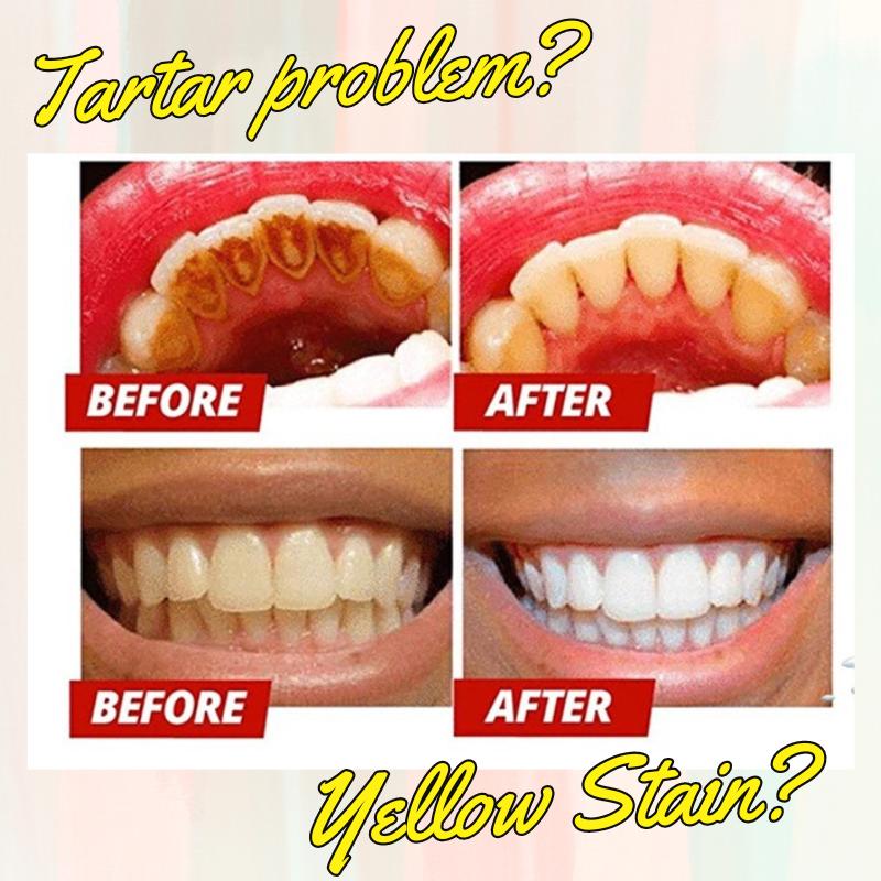 WE2C [SP-5 Probiotic Toothpaste] Whitens teeth, cleans the mouth, removes tooth stains, freshens breath, soft foam, jasmine whitening, mint freshness