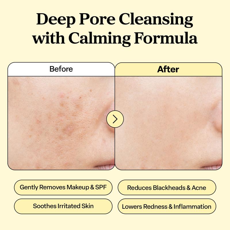 IUNIK Calendula Complete Cleansing Oil - Official Product Korean Gentle Blackhead Melting and Makeup Remover Facial Oil Cleanser (6.7 fl oz)