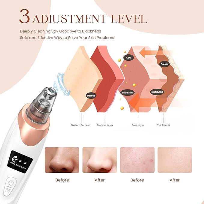 2024 Newest Blackhead Remover Pore Vacuum,Facial Pore Cleaner-5 Suction Power,5 Probes,USB Rechargeable Blackhead Vacuum Kit Electric Acne Extractor Tool nose vacuum electric acne