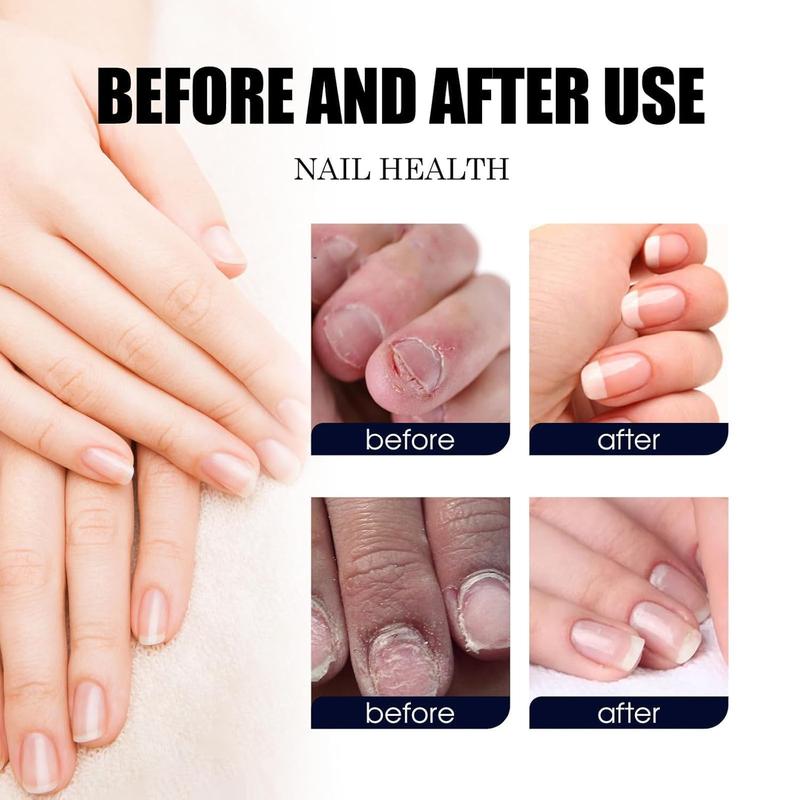Nail Care Moisturizer, Nail support with Basil Leaf Extract, Tea Tree Oil and Lavender Oils for nail fungus prevention, manicures Nail Polish Moisture Antibacterial
