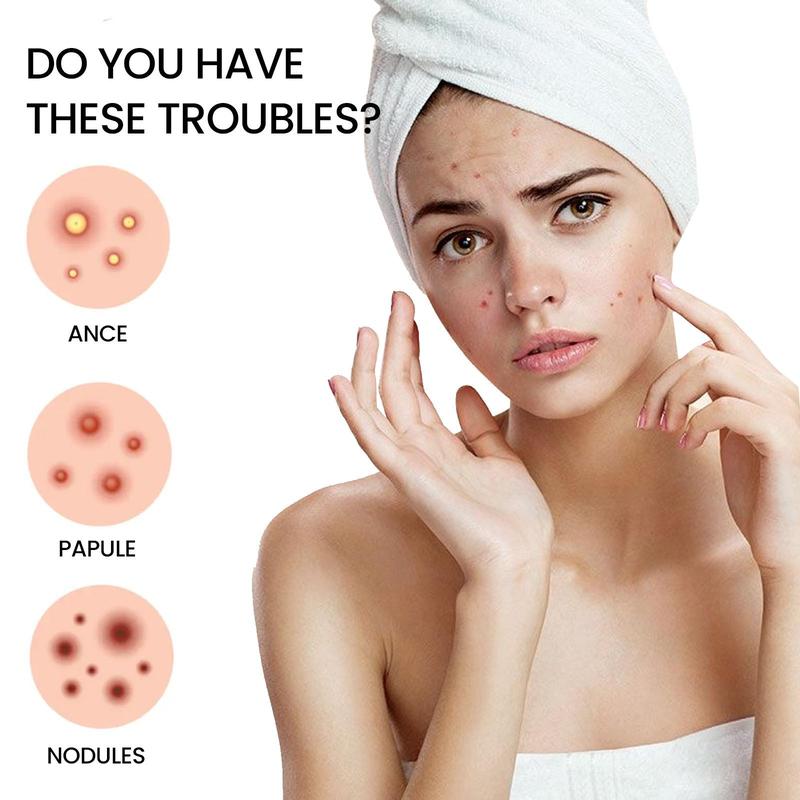 Star Shaped Colorful Acne Patch, 200pcs box Breathable Pimple Covering Sticker, Invisible Acne Patches, Skin Care Products for Women & Men
