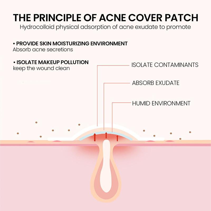Star Shaped Colorful Acne Patch, 200pcs box Breathable Pimple Covering Sticker, Invisible Acne Patches, Skin Care Products for Women & Men